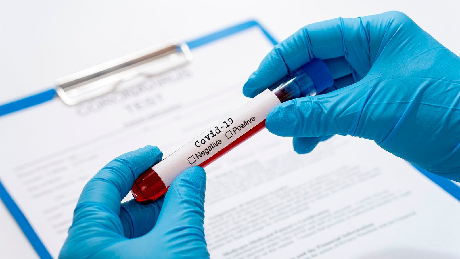 Thêm 28 ca mắc Covid-19, có 19 ca liên quan đến bệnh viện Đà Nẵng